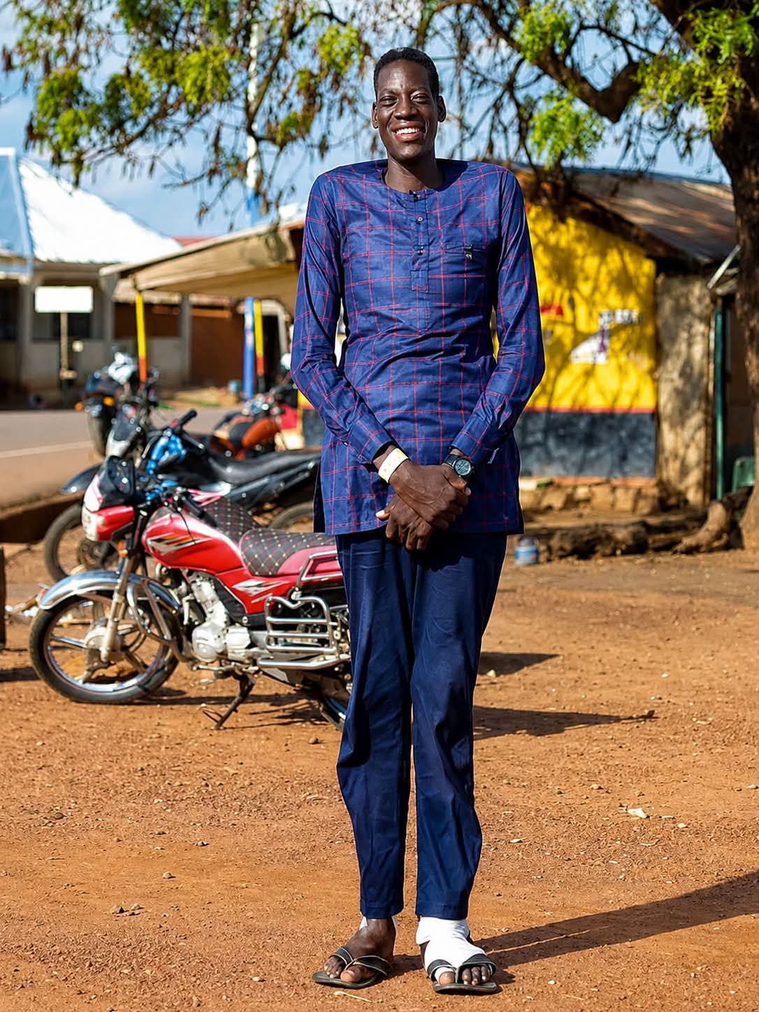 Ghana's Tallest Man, Awuche, Dies At 33