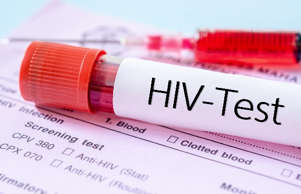 Ghana AIDS Commission Clarifies HIV Test Results From Security Recruitment Exercise